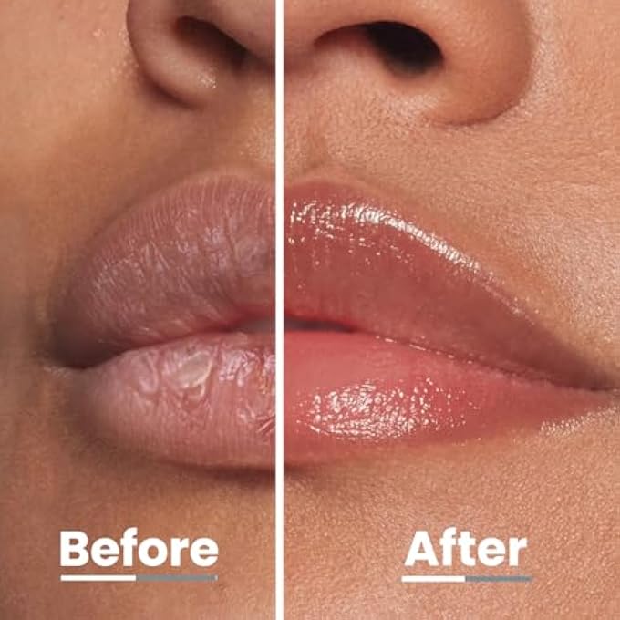 HYPHEN - PEACH LIP BALM FOR DRY & CHAPPED LIPS | VITAMIN INFUSED PEPTIDE | HYDRATING & MOISTURIZING BALM FOR MEN & WOMEN | PRODUCTS | LIP BALM SMOOTHEN LIPS & REPAIR MOISTURE BARRIER | VEGAN, - Image 4